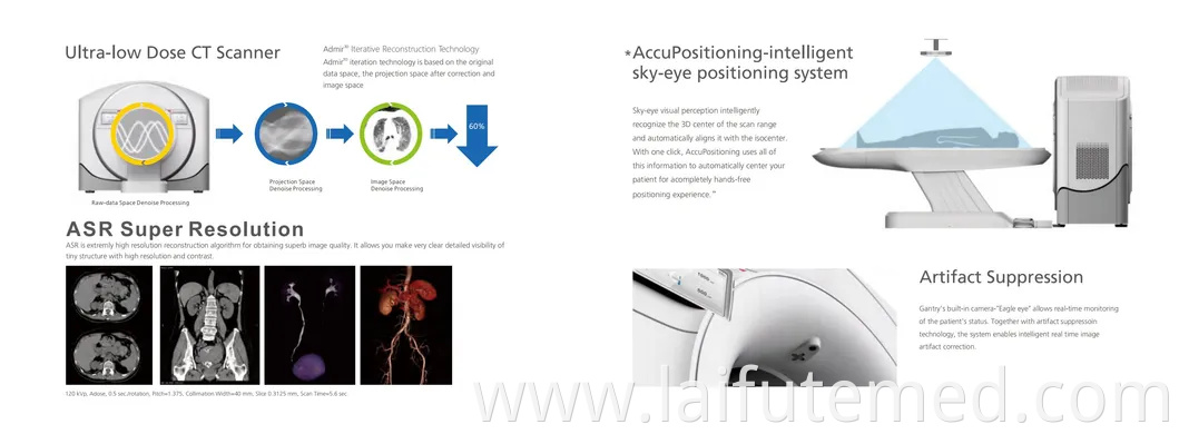 Advanced 512 Slice CT Scanner for Veterinary Imaging-High-Resolution 3D Diagnostics for Large Animals